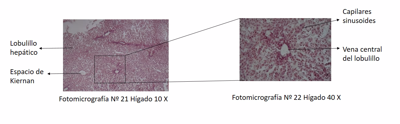 ¿Cómo se ve el hígado en histología?