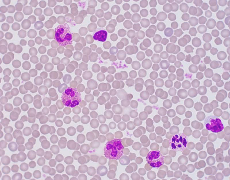 ¿Qué células presenta la sangre?