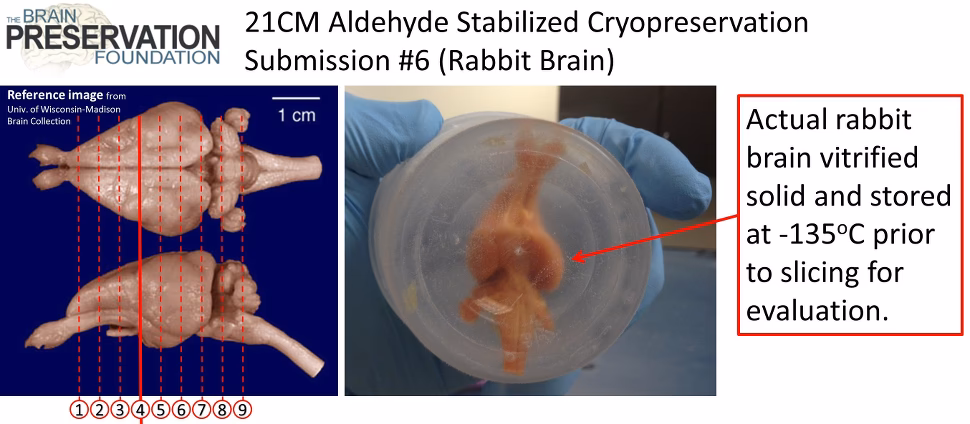 ¿Qué significa cerebro de conejo?