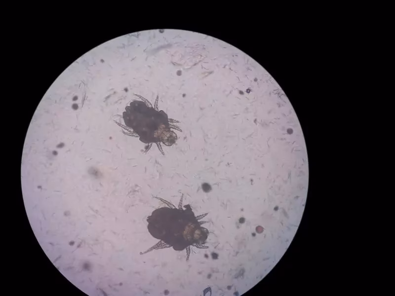 How do you get rid of Cheyletiella in humans?