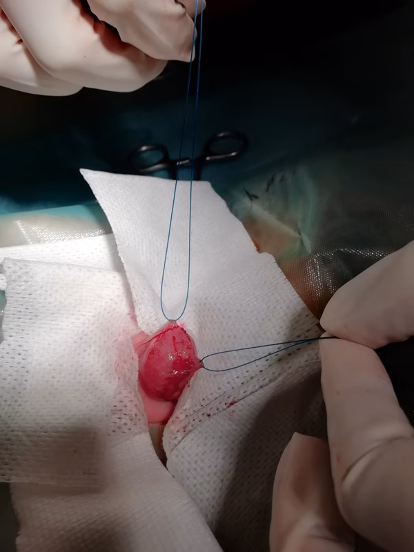 ¿Qué otro antibiótico sirve para la infección urinaria?