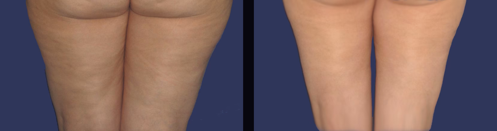 ¿Porque me salen conejos en las piernas?