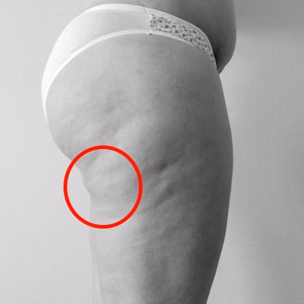 ¿Cómo terminar con la plaga de conejos?