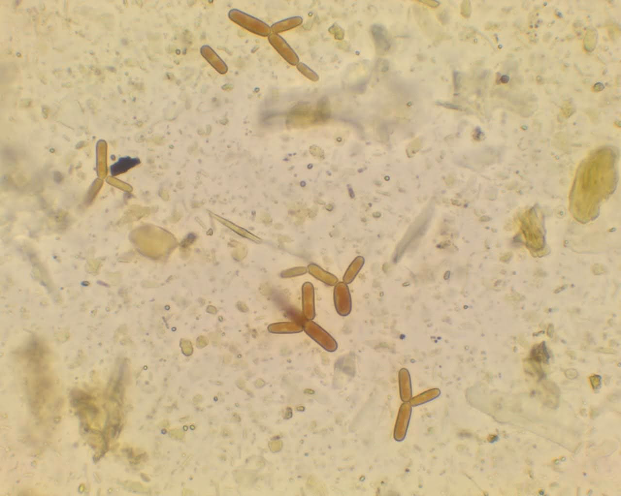 ¿Qué es Cyniclomyces en conejos?