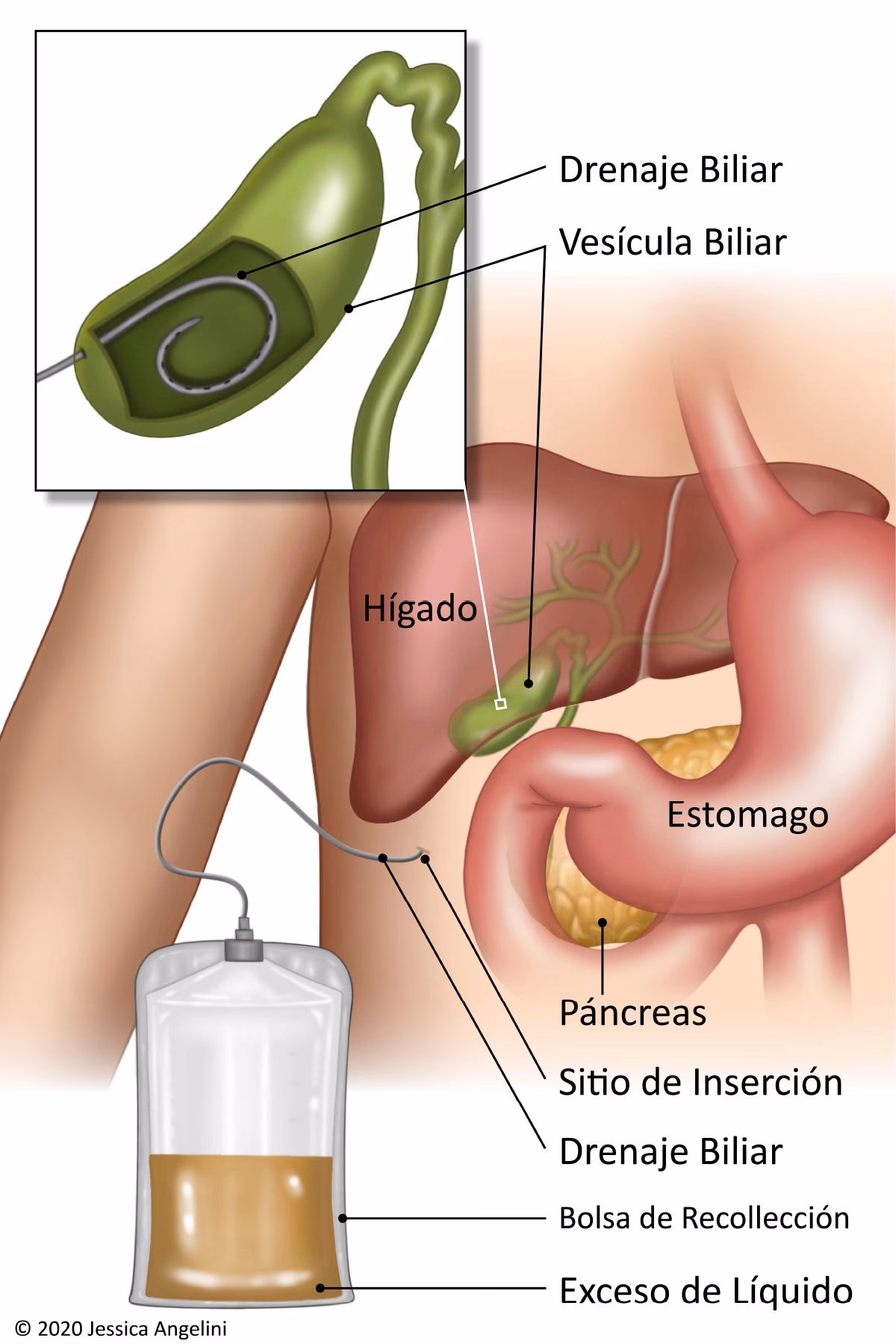 ¿Qué enfermedades cura la hiel de chivo?