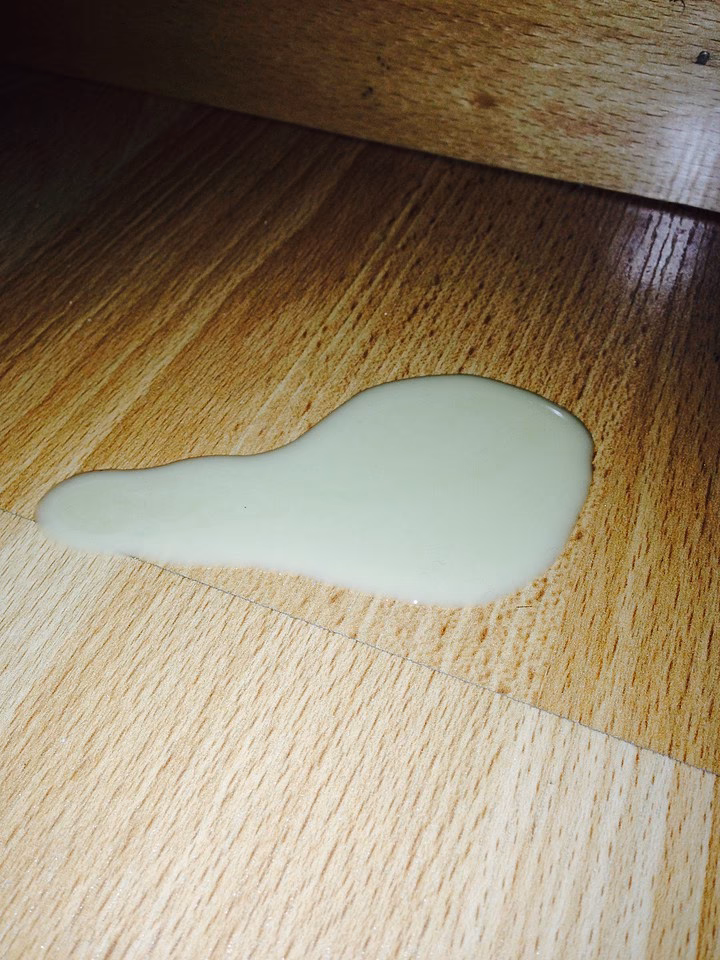 ¿Qué pasa si mi orina es de color blanco?