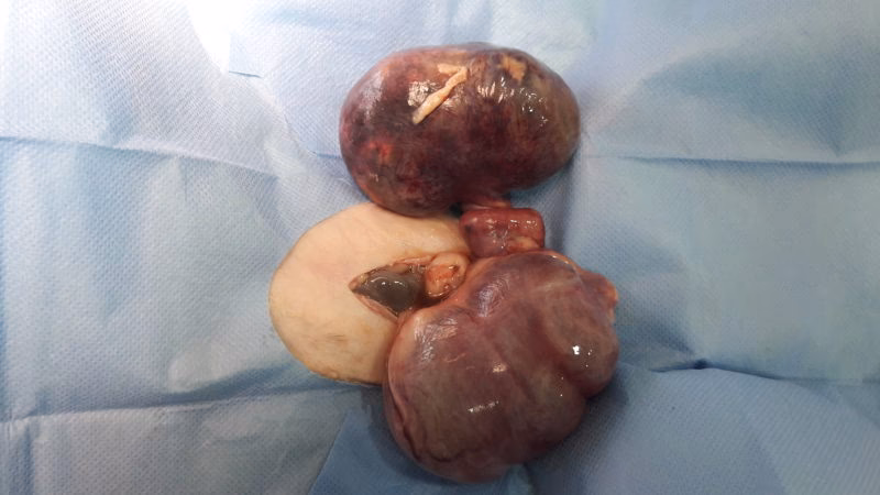 ¿Cuáles son los signos y síntomas del adenocarcinoma uterino en conejos?